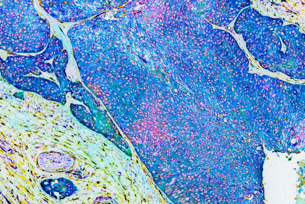 Image staining teaser
