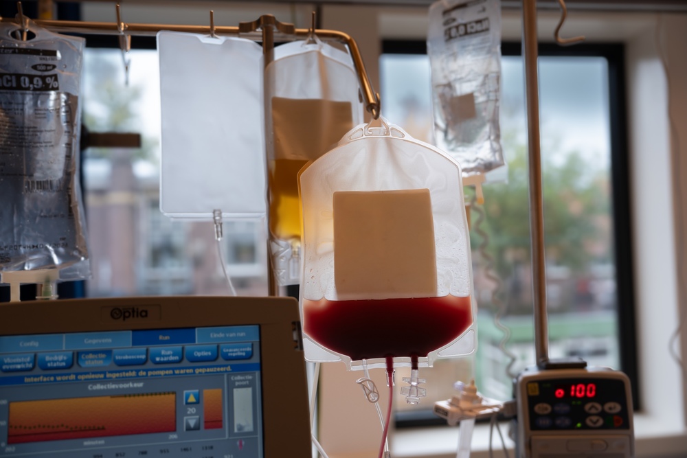 Stamceltransplantatie